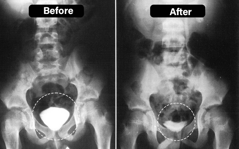 Pulseira de bem-estar da próstata Oveallgo™ TitaniumMag