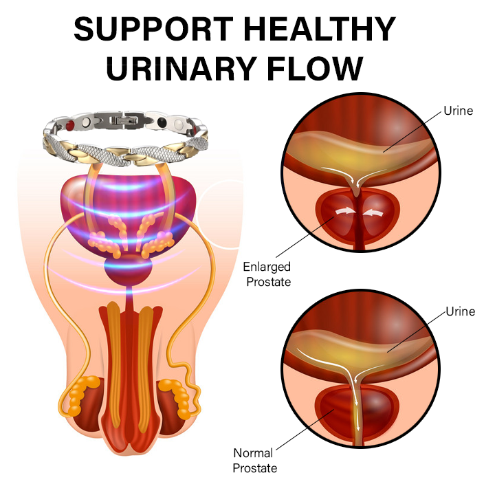 Pulseira magnética para a saúde da próstata Oveallgo™ CuPro