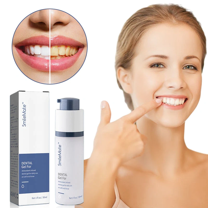 Gel restaurador refrescante e branqueador de dentes SmileMate