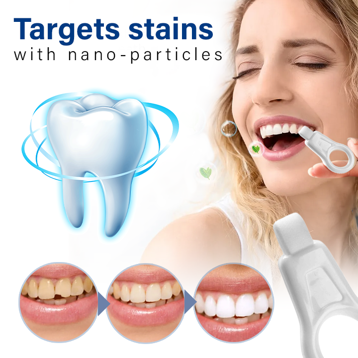 Fivfivgo™ NanoShine Limpador de Manchas nos Dentes