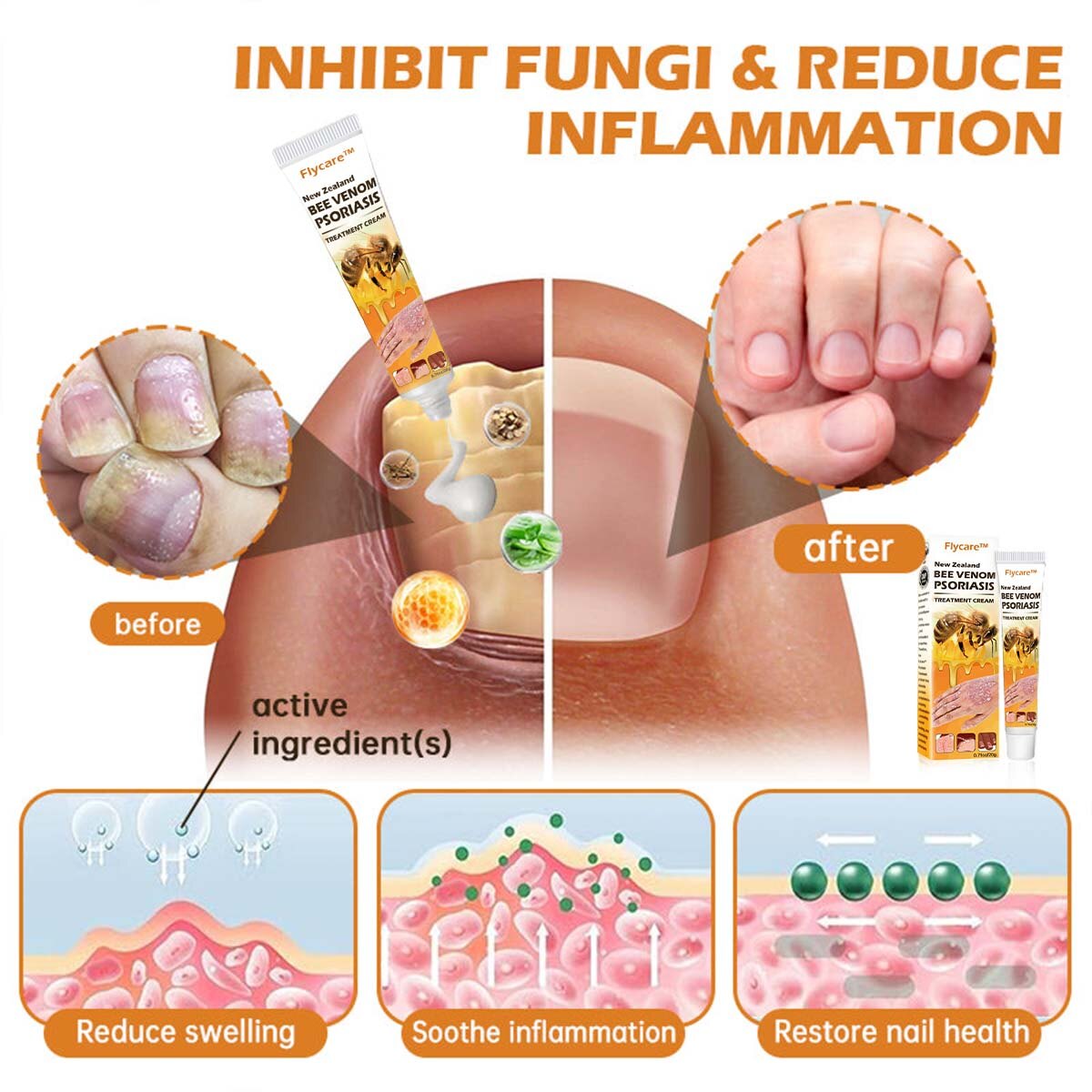 Creme de tratamento para psoríase com veneno de abelha da Nova Zelândia (adequado para todas as condições de pele)