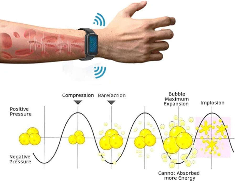 Pulseira ultrassônica de queima de gordura e desintoxicação Fivfivgo™