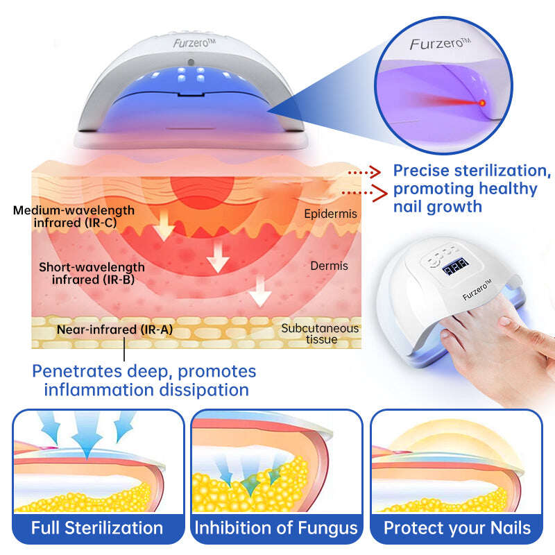 Dispositivo de tratamento de fungos a laser Furzero™ PureNail