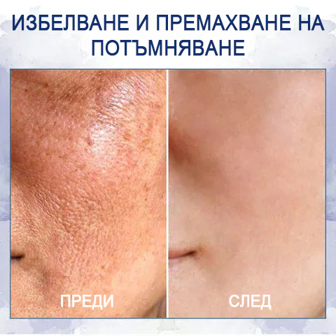 🔥👩‍⚕️ Poslední den výprodej: 75% sleva 🔥Fubsta® Advanced Firming Anti-Wrinkle Cream: Obnovte pružnost pokožky