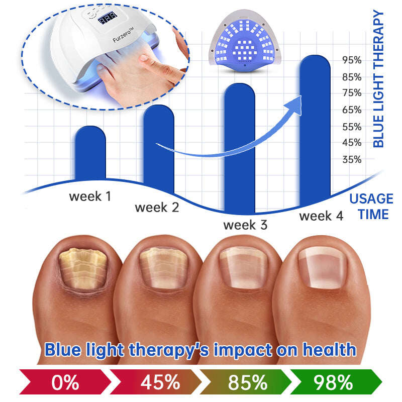 Dispositivo de tratamento de fungos a laser Furzero™ PureNail