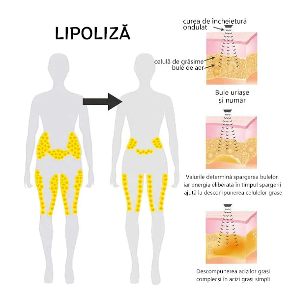 🌻J0SFIT™ Ultraskaņas programma detoksikācijai un tauku samazināšanai