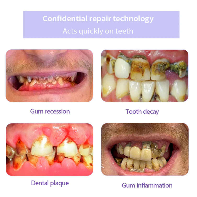 Pó Mineral para Restauração Dentária Fivfivgo™