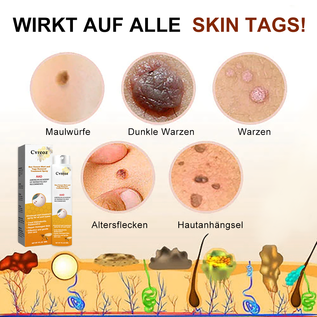 [🧡Magazin oficial al mărcii🧡]🥇Spray de tratament pentru îndepărtarea negilor și a etichetelor cu venin de albine Cvreoz (👨‍⚕AAD RECOMANDAT)🐝🐝(🔥Promoție de ultima zi 80% reducere)