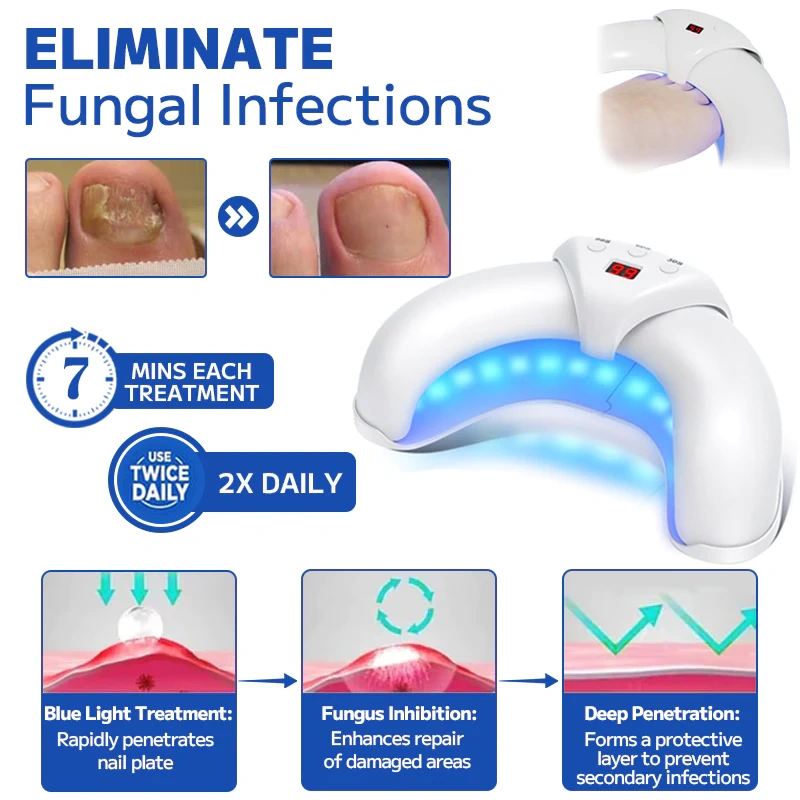 Dispositivo de tratamento a laser para fungos nas unhas Furzero™