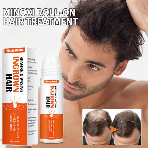 Re:act Minoxi Roll-on Hair Treatment, jauns matu augšanas serums 2023