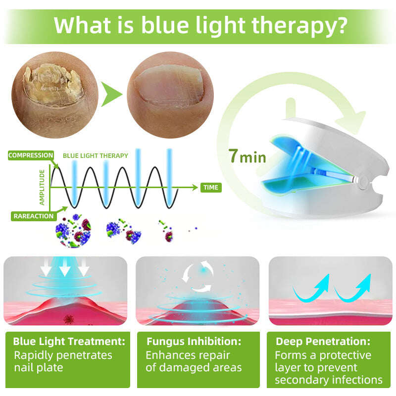 Dispositivo de tratamento a laser para fungos nas unhas 