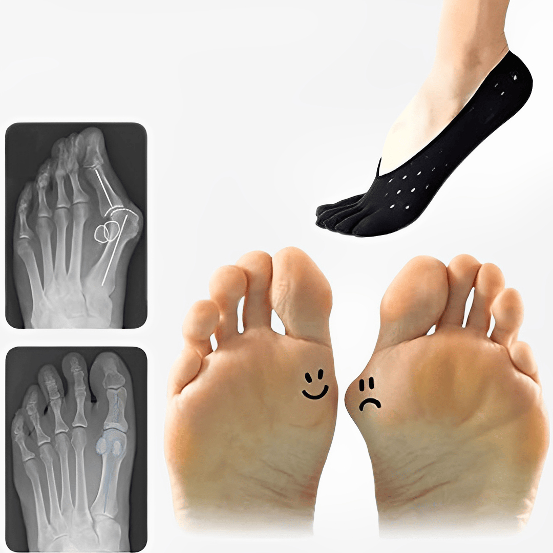 Bunion Corrective Toe Socks🔥Pokud se po použití nedostaví žádný účinek, okamžitě vraťte peníze!