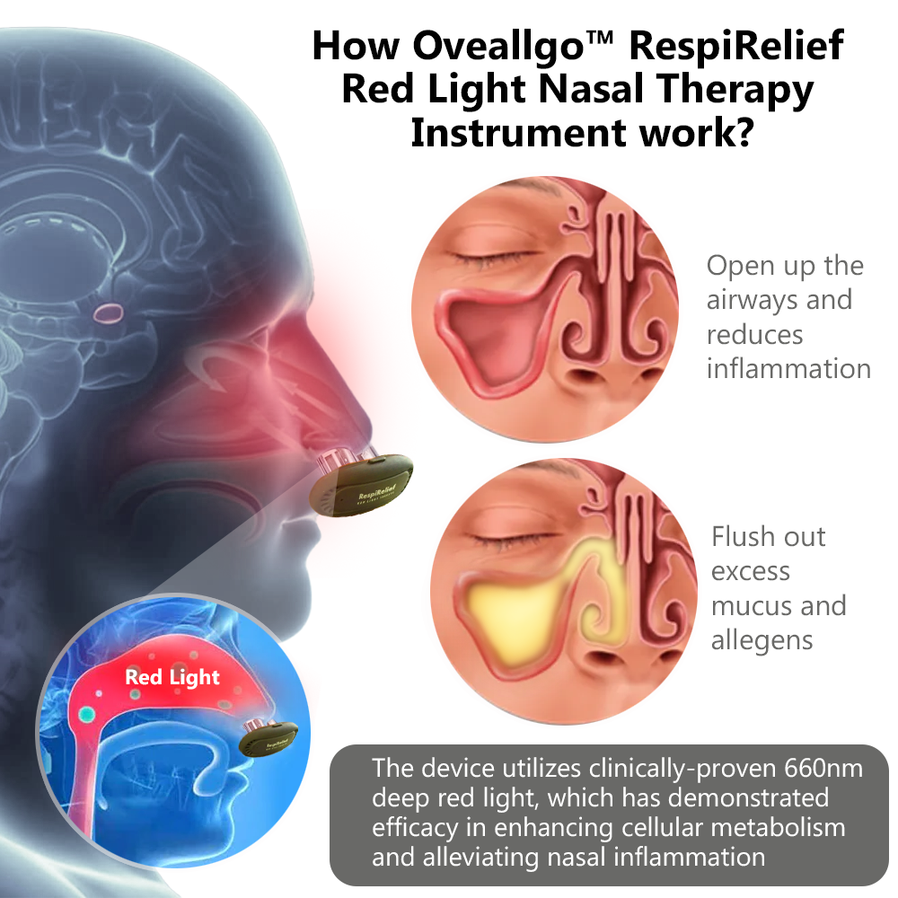 Instrumento de terapia nasal com luz vermelha Fivfivgo™ RespiRelief