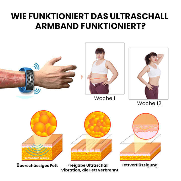 Oveallgo™ MatteoMiracle ultrahangos testformáló karkötő