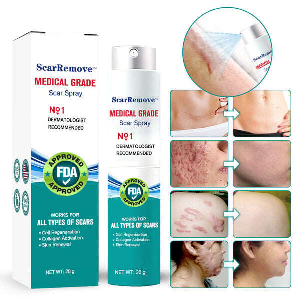 ❤️ScarRemove™ spray avançado para cicatrizes para todos os tipos de cicatrizes - tais como cicatrizes de acne, cicatrizes cirúrgicas e estrias ⚡️⚡️⚡️