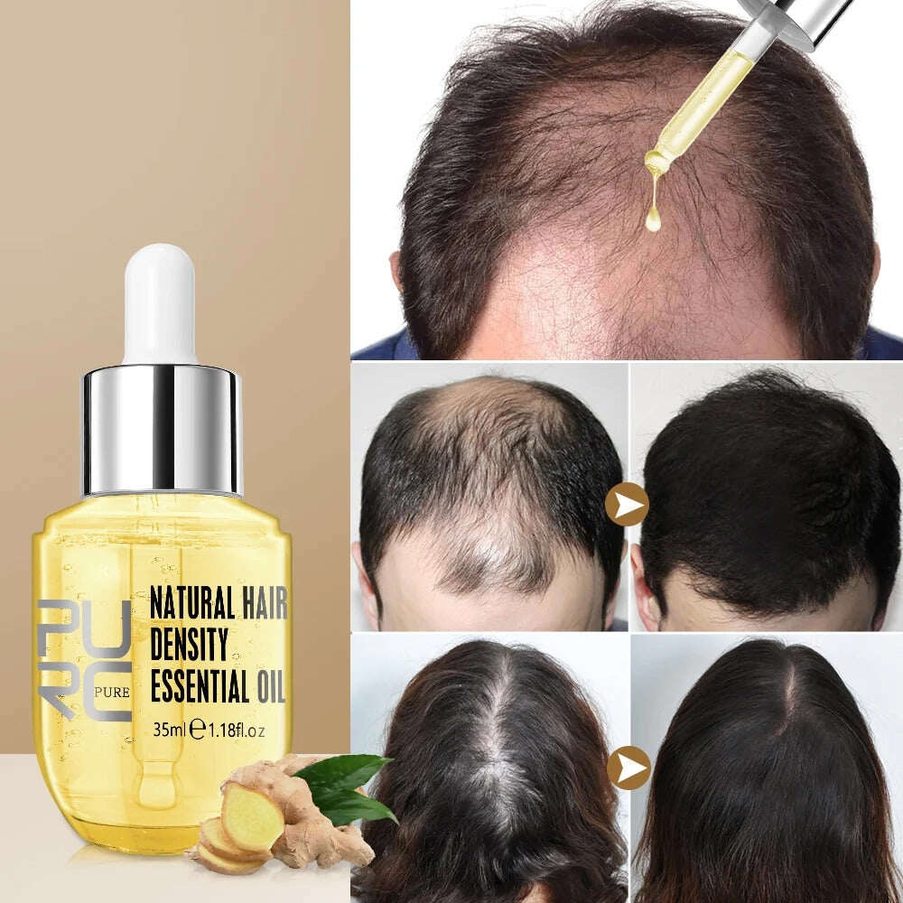 Último dia de promoção 70% OFF - 🔥 Óleo para Crescimento do Cabelo