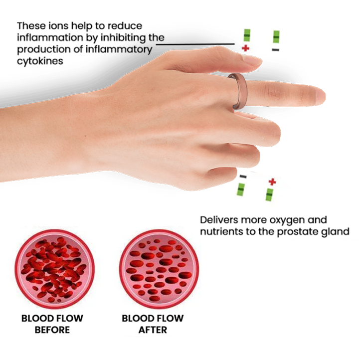 Anel de próstata magnético de cobre Oveallgo™