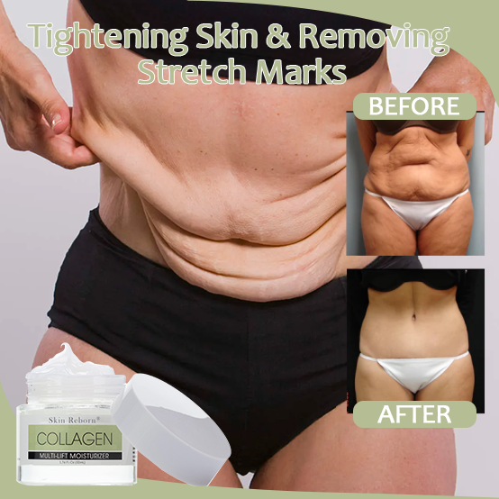 REBORN SKIN® COLLAGEN BOOST FAST FIRMING & LIFTING CREAM