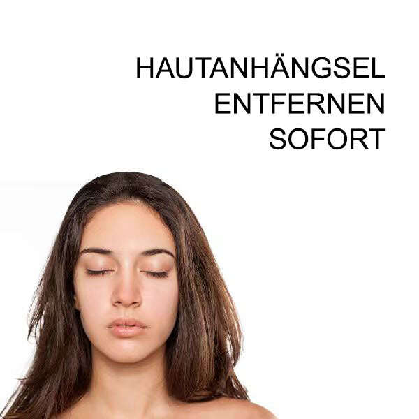 [🧡Magazin oficial al mărcii🧡]🥇Spray de tratament pentru îndepărtarea negilor și a etichetelor cu venin de albine Cvreoz (👨‍⚕AAD RECOMANDAT)🐝🐝(🔥Promoție de ultima zi 80% reducere)